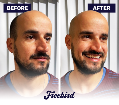 𝗙𝗶𝗻𝗲𝘀𝘀𝗲 𝗕𝗹𝗮𝗱𝗲 - 𝗦𝗰𝗵𝗲𝗲𝗿𝗮𝗽𝗽𝗮𝗿𝗮𝗮𝘁